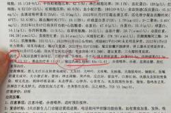 什么是新生儿溶血症