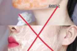 怀孕能激光去脂肪粒吗