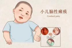 新生儿脑损伤早期有啥表现