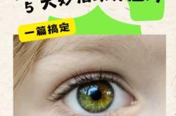 婴儿睫毛倒长怎么办