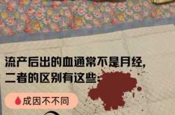 产后子宫出血怎么办