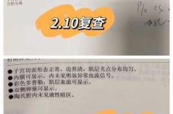 瘢痕憩室很大影响备孕吗