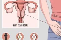 产后恶露干净后为何又出血