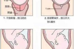 顺产后如何躺好