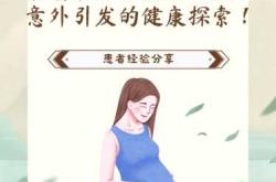 备孕谁吃叶酸片