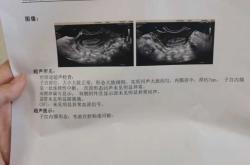 流产后50多天不来月经为什么