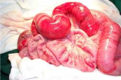 产后45天鲜红色血啥情况