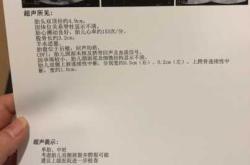 备孕拍胸片遮住肚子有用吗