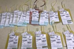 剖腹产41天来点鲜红血正常吗