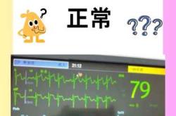 新生儿正常心率是多少