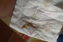 剖腹产后褐色果冻状正常吗