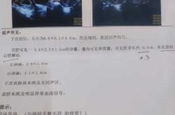 流血孕反消失是胎停吗