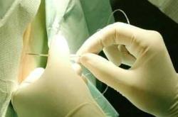 剖腹产打麻药痛苦吗视频