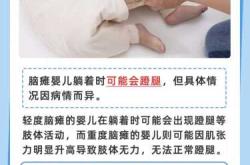 什么是婴儿早期良性肌阵挛
