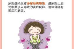 备孕如何避免尿路感染