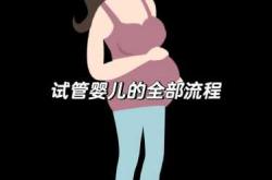 试管婴儿有哪些相关疑问