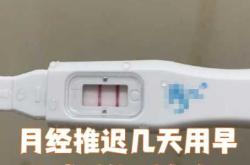 月经推迟四天能否测出怀孕