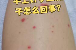 产后出现血点怎么办