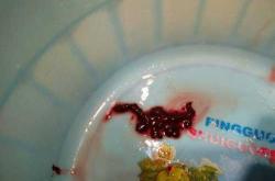 药流后三个月能怀孕吗