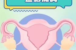 备孕前期需做造影吗