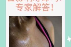 产后总出汗是怎么回事