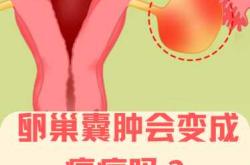 双侧卵巢囊肿影响怀孕吗