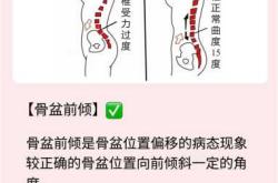 产后胯骨变宽咋恢复运动