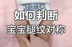 婴儿腿型不正常怎么办