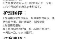 剖腹产多久可以坐起来