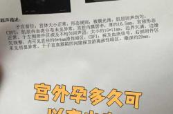 怀孕大概多少天能查出来