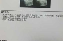 孕十一周孕反正常吗