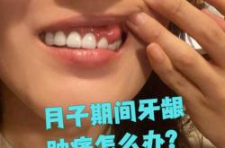 月子里肿了是怎么回事