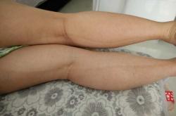 备孕月经前2天腿酸痛正常吗