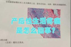 产后会阴疼是怎么回事