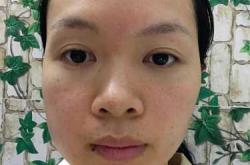 拔牙拍片不影响备孕吗