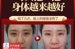 产后风发汗真的有效果吗