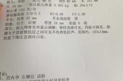 备孕中梦喜小孩咋回事