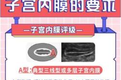 试管婴儿为什么会生化