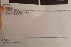 孕反8周5天有什么表现