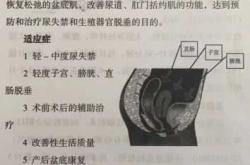 产后缩阴办法有哪些