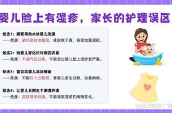 新生儿湿疹挂哪个科