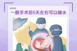 剖腹产送产妇该注意些什么