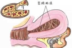 婴儿阴道粘连怎么办