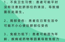新生儿肚脐臭怎么办