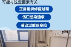 产后撕裂伤口多久能不疼