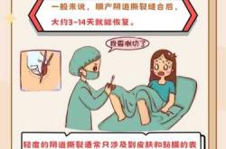 女子顺产会遇到哪些状况