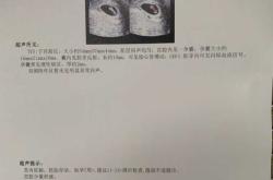 备孕老公梦见我来例假是怎么回事