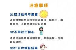 备孕期间能不能做胃肠镜检查