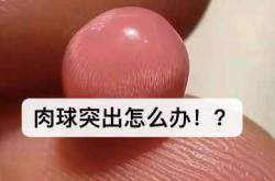 二胎产后有痔疮该怎么办