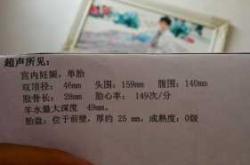 48岁拼4胎备孕好吗